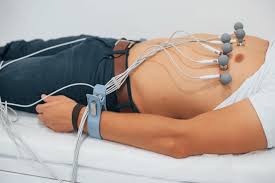ECG